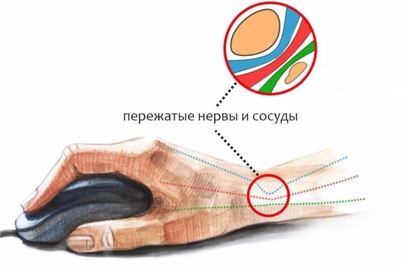 Что такое кракен сайт